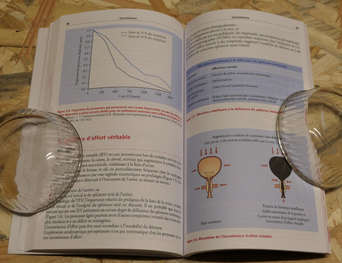 L'EXAMEN URODYNAMIQUE RENDU FACILE / MEDECINE UROLOGIE GYNECOLOGIE MALOINE 2003